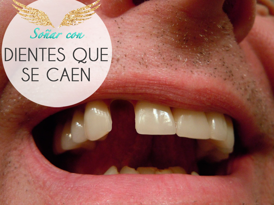 Qué Significa Soñar que se te Caen los Dientes - El Significado de los